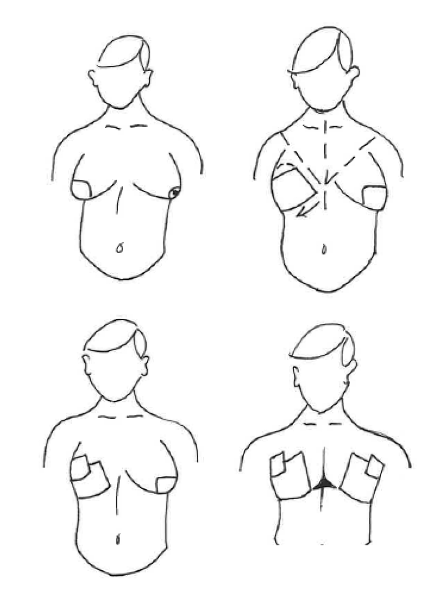 Trans Tape Chest Application Instructions